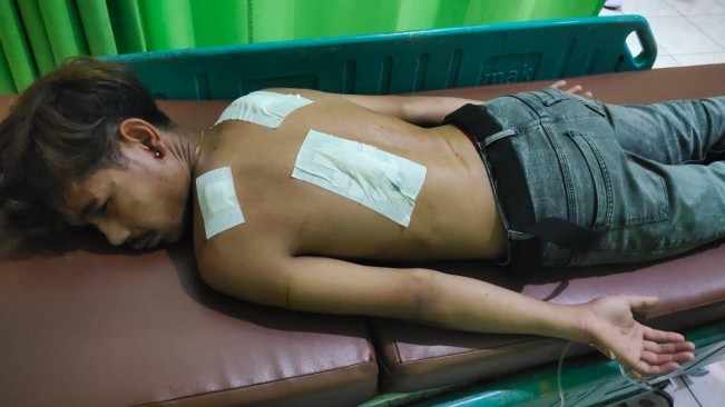 Salah seorang korban yang mengalami luka-luka. [Istimewa]